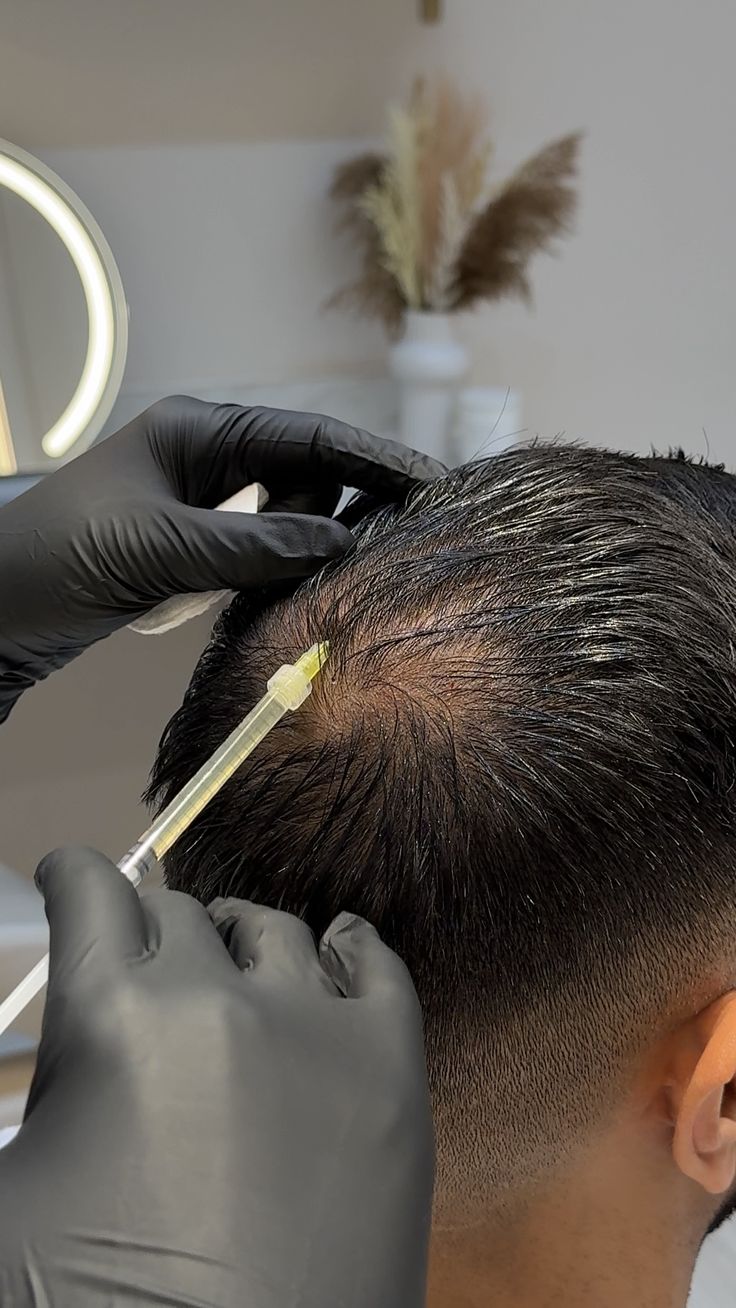 Thinning Hair